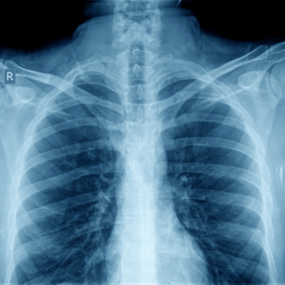 portable-x-ray-machines-hero-image