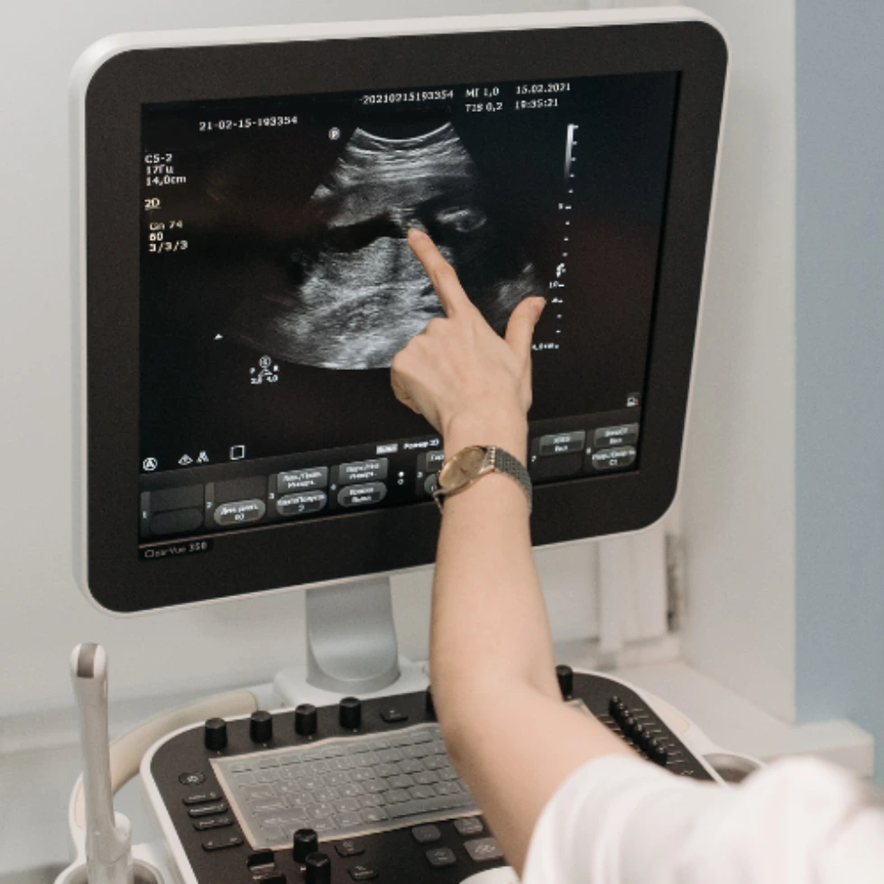 ultrasound-machines-for-sale-hero-image